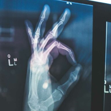 Imágen de recurso-fisioterapia sinergia-08